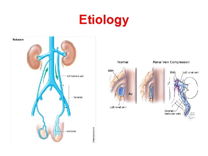 Etiology 