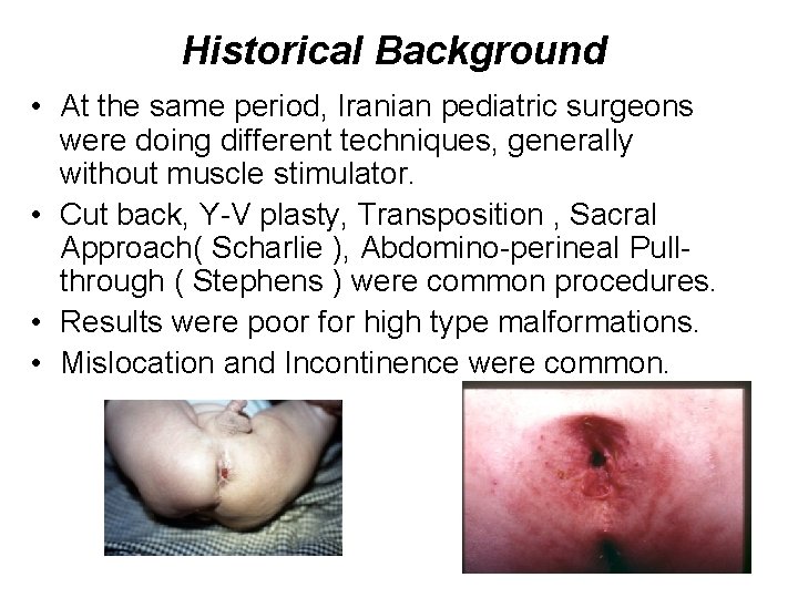 Historical Background • At the same period, Iranian pediatric surgeons were doing different techniques,
