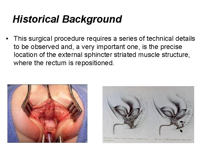 Historical Background • This surgical procedure requires a series of technical details to be