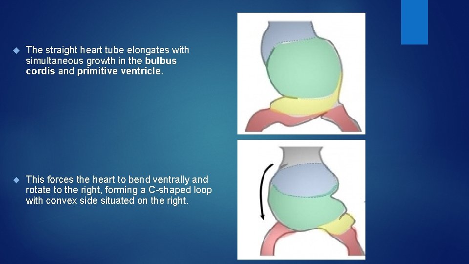  The straight heart tube elongates with simultaneous growth in the bulbus cordis and