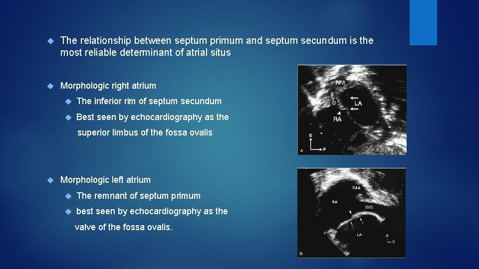  The relationship between septum primum and septum secundum is the most reliable determinant