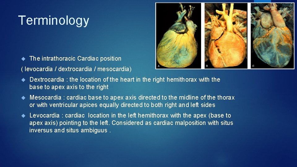 Terminology The intrathoracic Cardiac position ( levocardia / dextrocardia / mesocardia) Dextrocardia : the