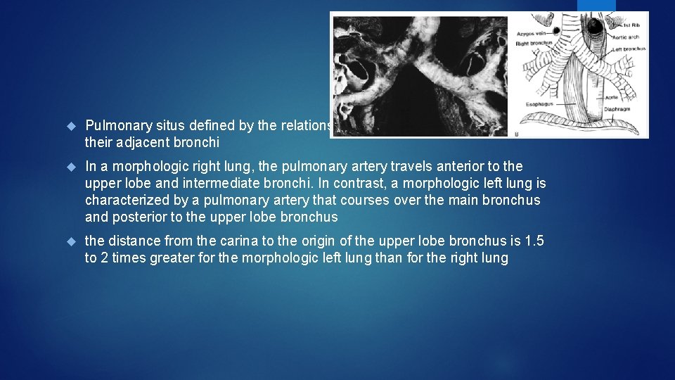  Pulmonary situs defined by the relationship of the pulmonary arteries to their adjacent