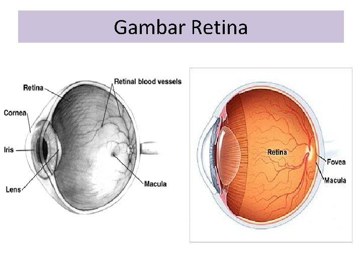 Gambar Retina 