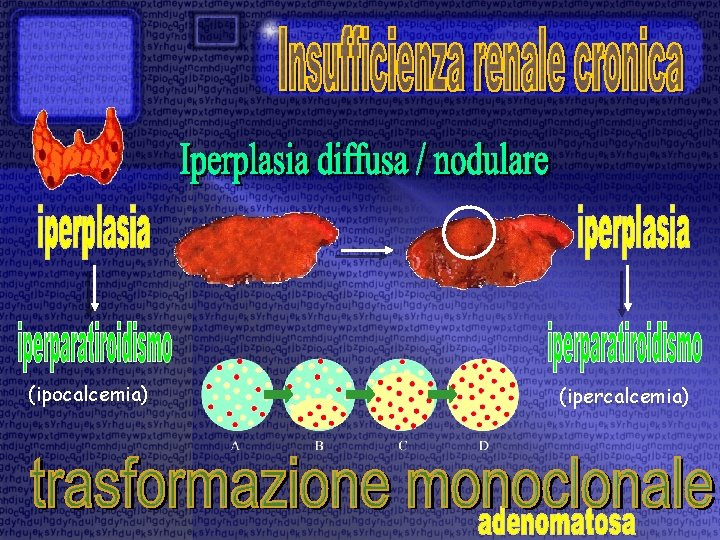 (ipocalcemia) (ipercalcemia) 