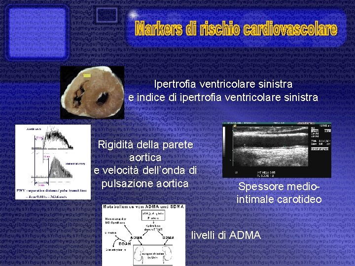 Ipertrofia ventricolare sinistra e indice di ipertrofia ventricolare sinistra Rigidità della parete aortica e