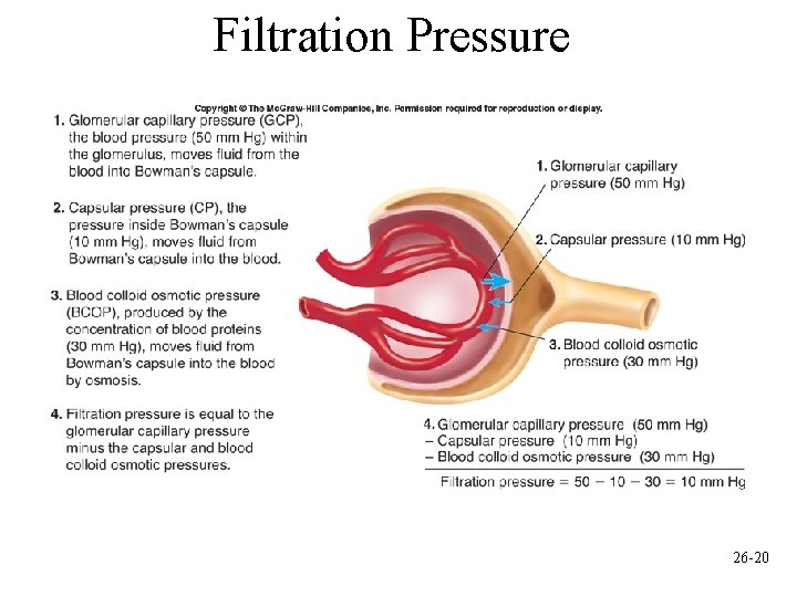 Filtration Pressure 26 -20 