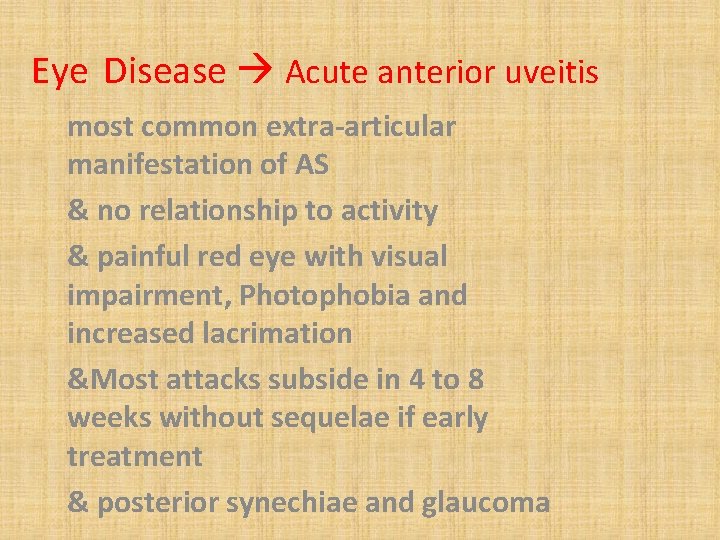Eye Disease Acute anterior uveitis most common extra-articular manifestation of AS & no relationship