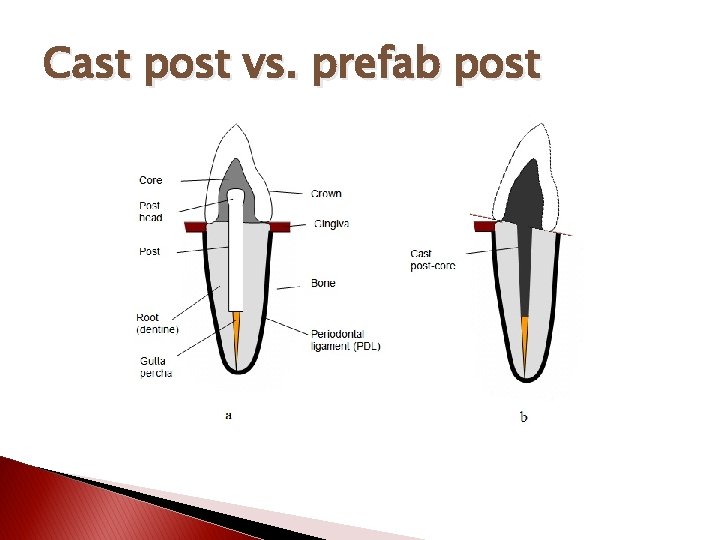 Cast post vs. prefab post 