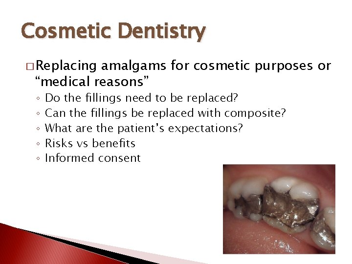 Cosmetic Dentistry � Replacing amalgams for cosmetic purposes or “medical reasons” ◦ ◦ ◦