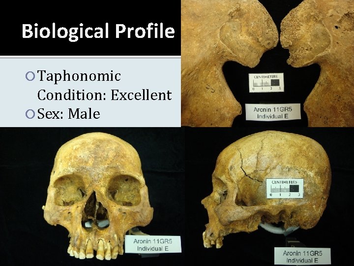 Biological Profile Taphonomic Condition: Excellent Sex: Male 
