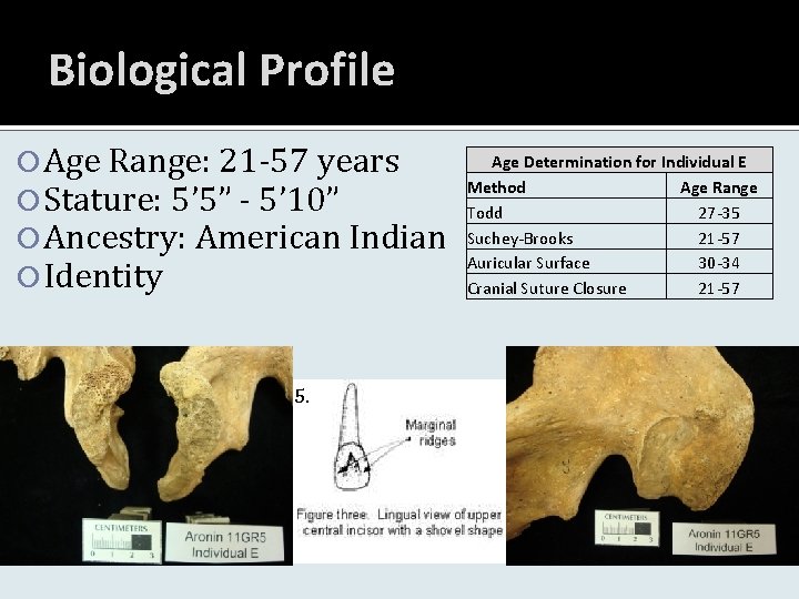 Biological Profile Age Range: 21 -57 years Stature: 5’ 5” - 5’ 10” Ancestry: