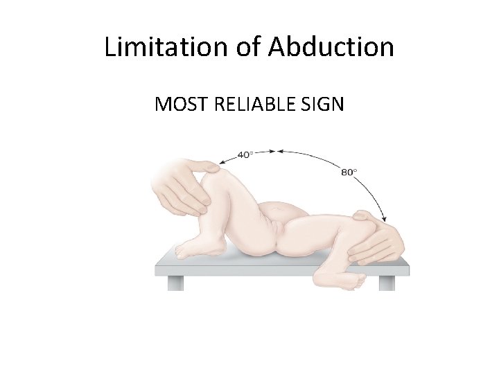 Limitation of Abduction MOST RELIABLE SIGN 