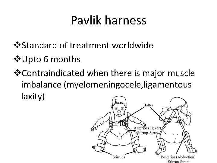 Pavlik harness v. Standard of treatment worldwide v. Upto 6 months v. Contraindicated when