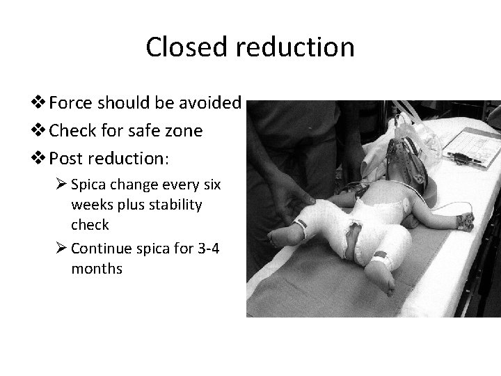 Closed reduction v Force should be avoided v Check for safe zone v Post