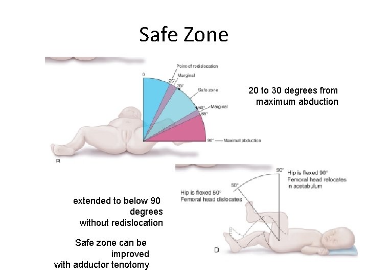 Safe Zone 20 to 30 degrees from maximum abduction extended to below 90 degrees