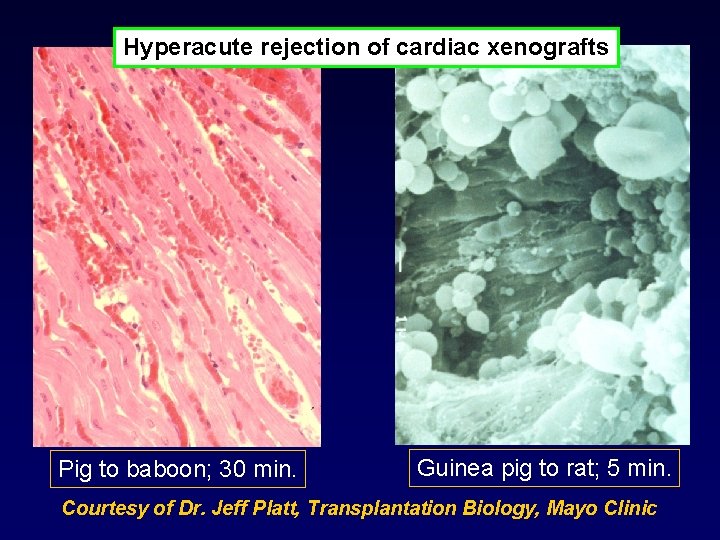 Hyperacute rejection of cardiac xenografts Pig to baboon; 30 min. Guinea pig to rat;