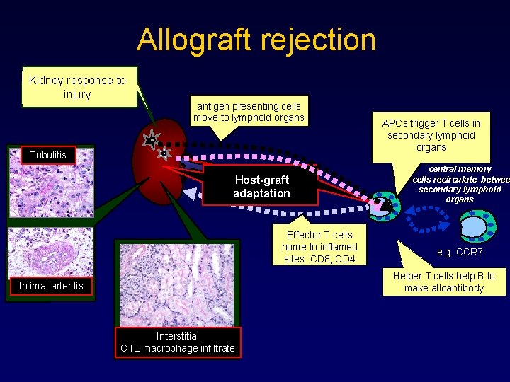 Allograft rejection Kidney response to injury antigen presenting cells move to lymphoid organs Tubulitis