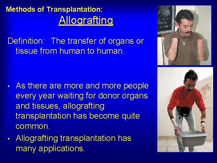 Methods of Transplantation: Allografting Definition: The transfer of organs or tissue from human to