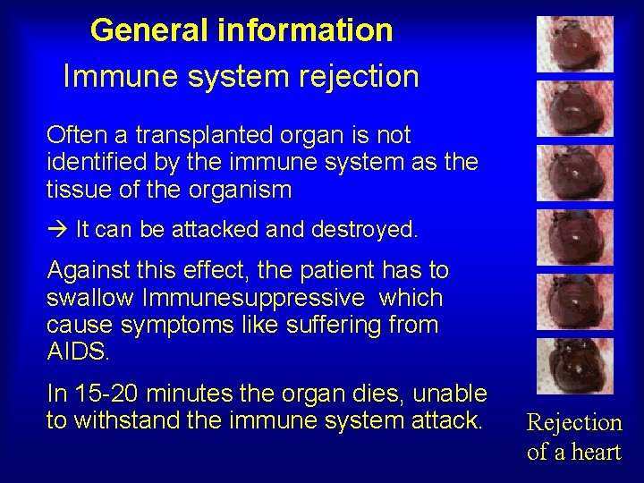 General information Immune system rejection Often a transplanted organ is not identified by the