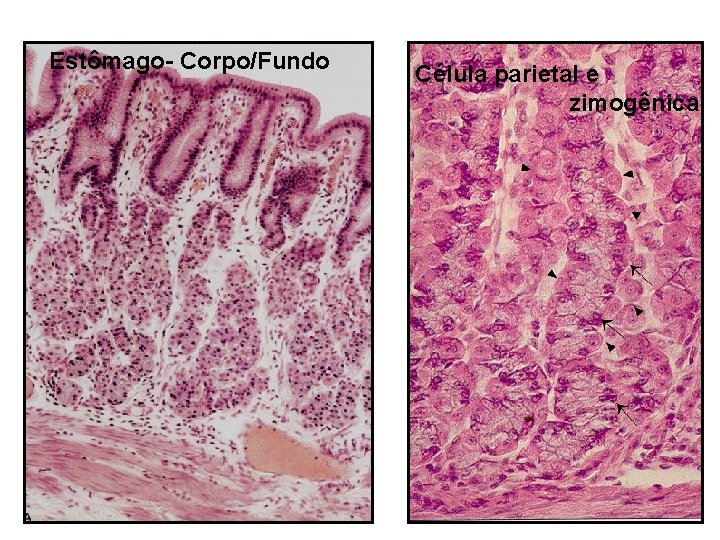 Estômago- Corpo/Fundo Célula parietal e zimogênica 