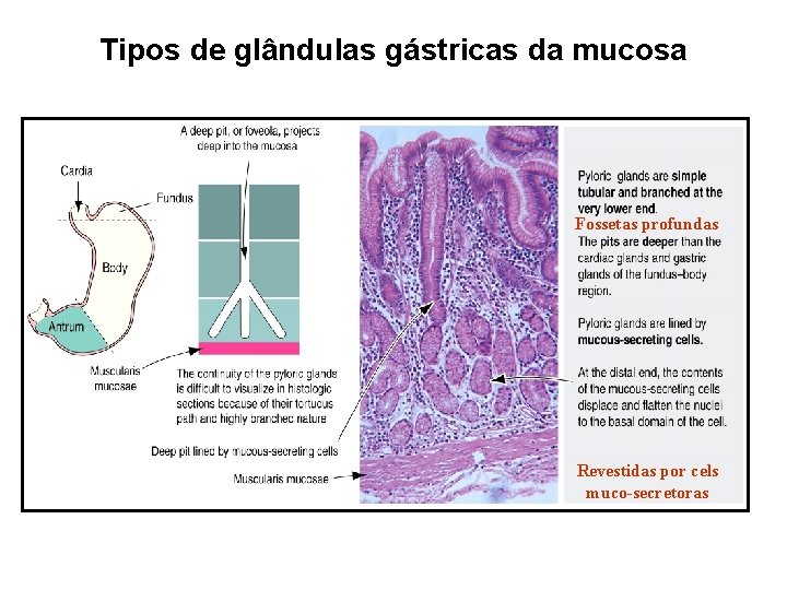 Tipos de glândulas gástricas da mucosa Fossetas profundas Revestidas por cels muco-secretoras 