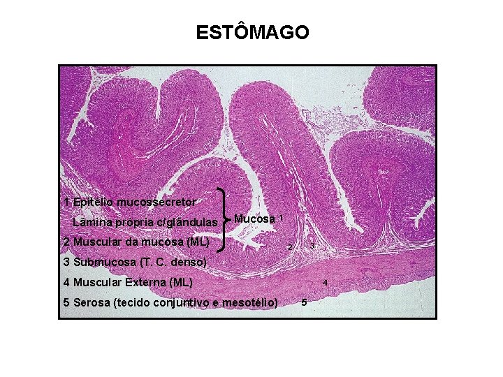 ESTÔMAGO 1 Epitélio mucossecretor Lâmina própria c/glândulas Mucosa 2 Muscular da mucosa (ML) 3