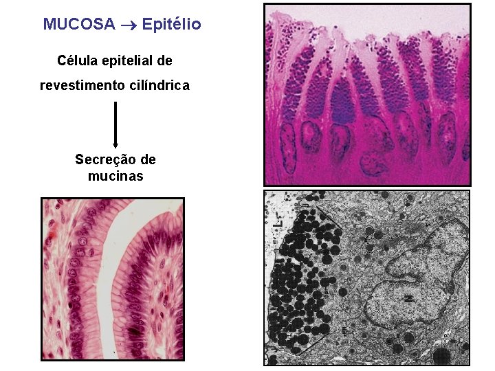 MUCOSA Epitélio Célula epitelial de revestimento cilíndrica Secreção de mucinas 