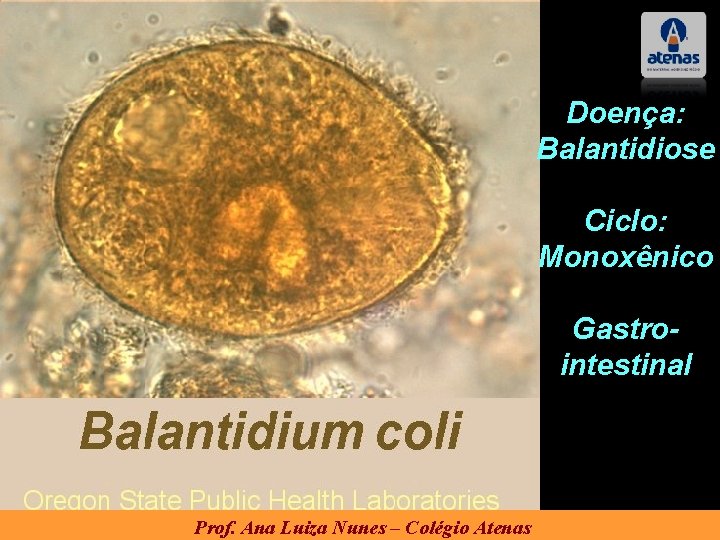 Doença: Balantidiose Ciclo: Monoxênico Gastrointestinal Prof. Ana Luiza Nunes – Colégio Atenas 