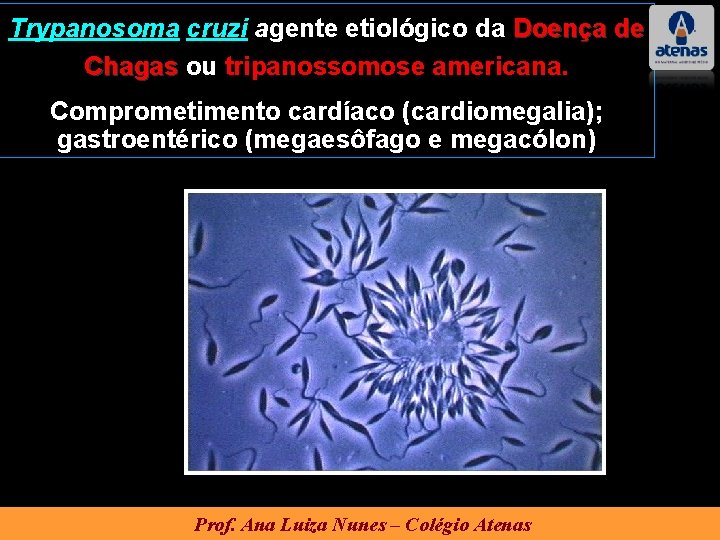 Trypanosoma cruzi agente etiológico da Doença de Chagas ou tripanossomose americana. Comprometimento cardíaco (cardiomegalia);