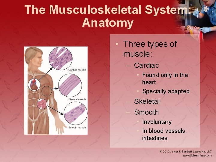The Musculoskeletal System: Anatomy • Three types of muscle: – Cardiac • Found only