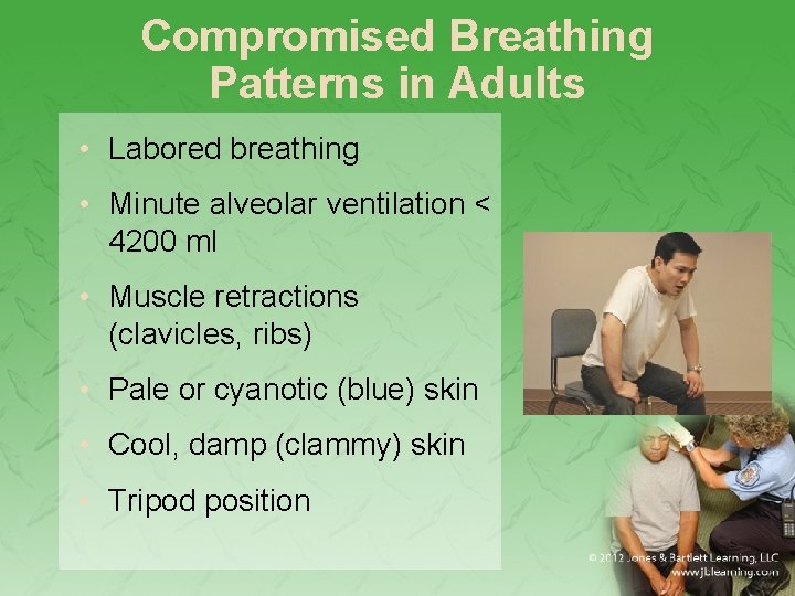 Compromised Breathing Patterns in Adults • Labored breathing • Minute alveolar ventilation < 4200