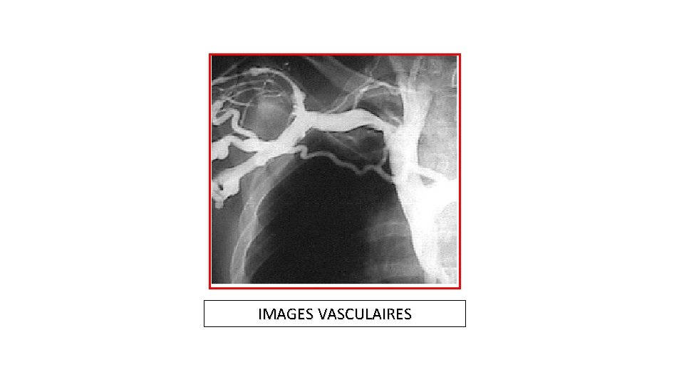 IMAGES VASCULAIRES 