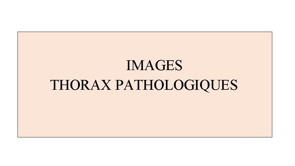  IMAGES THORAX PATHOLOGIQUES 