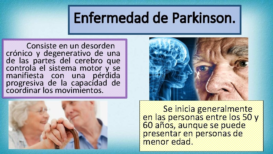 Enfermedad de Parkinson. Consiste en un desorden crónico y degenerativo de una de las