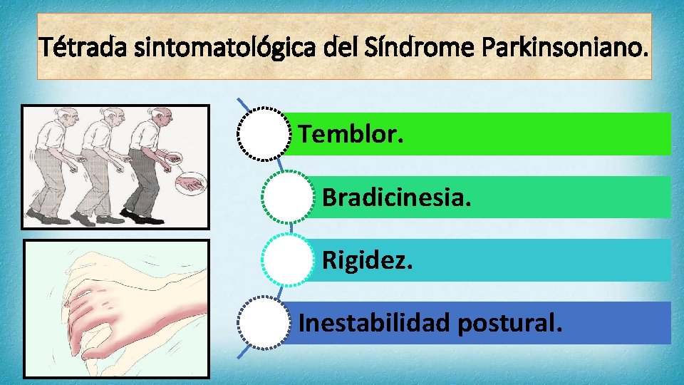 Tétrada sintomatológica del Síndrome Parkinsoniano. Temblor. Bradicinesia. Rigidez. Inestabilidad postural. 