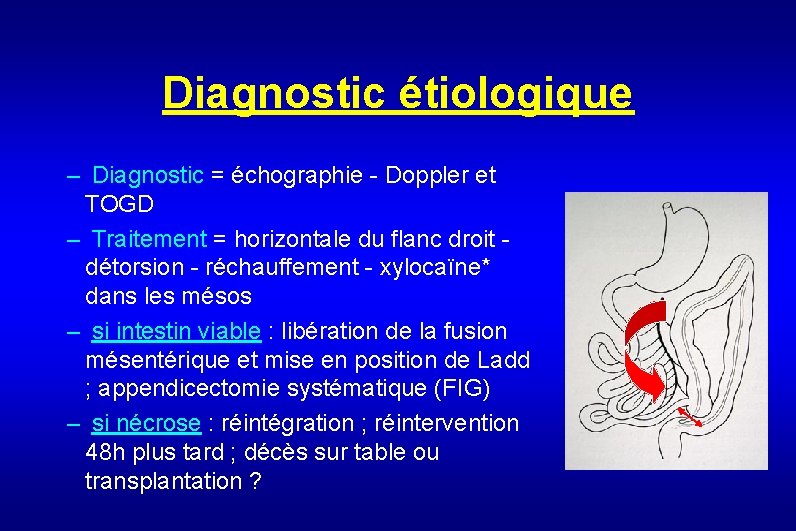 Diagnostic étiologique – Diagnostic = échographie - Doppler et TOGD – Traitement = horizontale