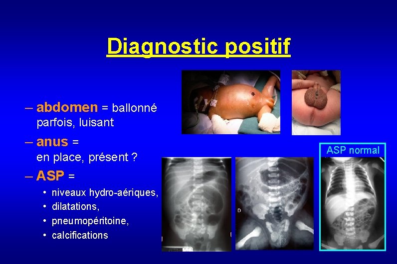 Diagnostic positif – abdomen = ballonné parfois, luisant – anus = en place, présent