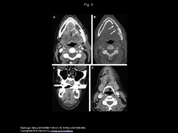 Fig. 9 Radiologic Clinics 2015 5399 -114 DOI: (10. 1016/j. rcl. 2014. 09. 003)