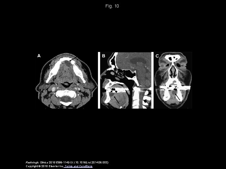 Fig. 10 Radiologic Clinics 2015 5399 -114 DOI: (10. 1016/j. rcl. 2014. 09. 003)