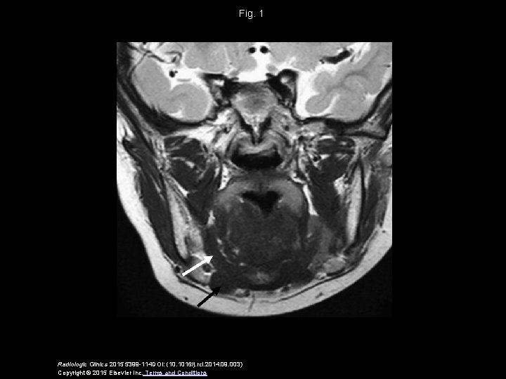 Fig. 1 Radiologic Clinics 2015 5399 -114 DOI: (10. 1016/j. rcl. 2014. 09. 003)