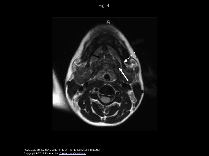 Fig. 4 Radiologic Clinics 2015 5399 -114 DOI: (10. 1016/j. rcl. 2014. 09. 003)