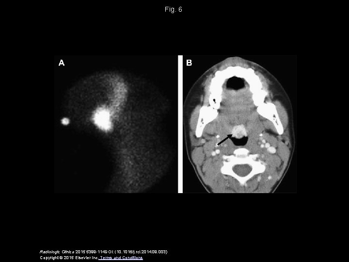 Fig. 6 Radiologic Clinics 2015 5399 -114 DOI: (10. 1016/j. rcl. 2014. 09. 003)