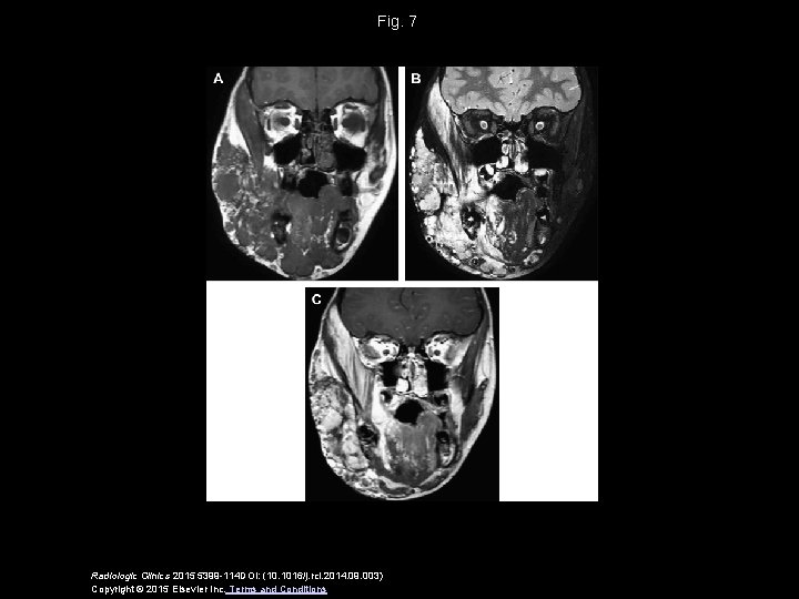 Fig. 7 Radiologic Clinics 2015 5399 -114 DOI: (10. 1016/j. rcl. 2014. 09. 003)