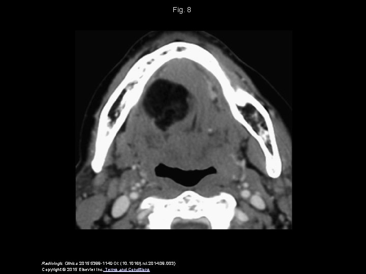 Fig. 8 Radiologic Clinics 2015 5399 -114 DOI: (10. 1016/j. rcl. 2014. 09. 003)