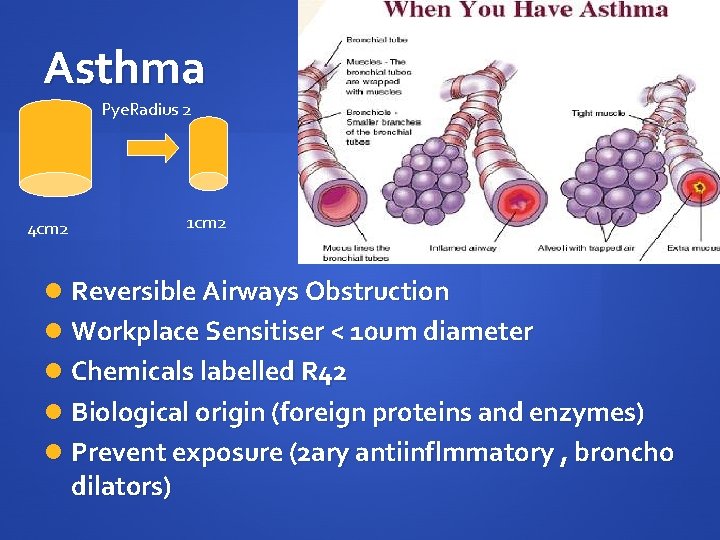 Asthma Pye. Radius 2 1 cm 2 4 cm 2 Reversible Airways Obstruction Workplace