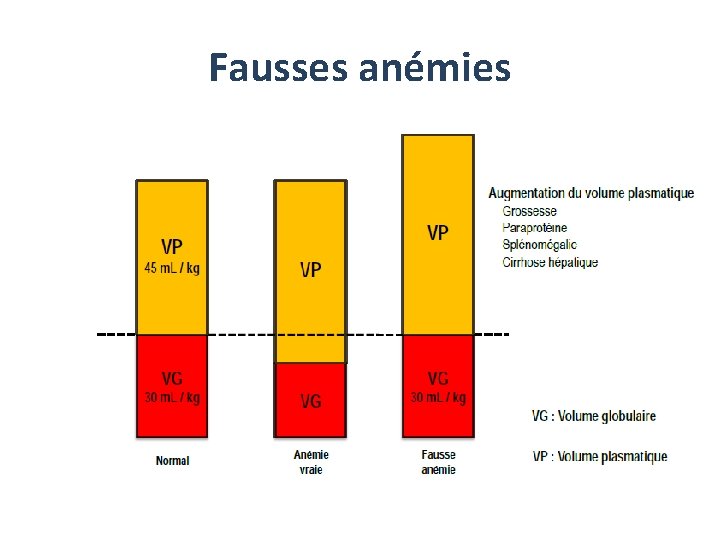 Fausses anémies Fausses anémies
