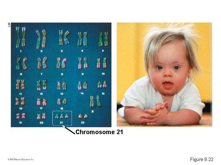 LM Chromosome 21 Figure 8. 22 