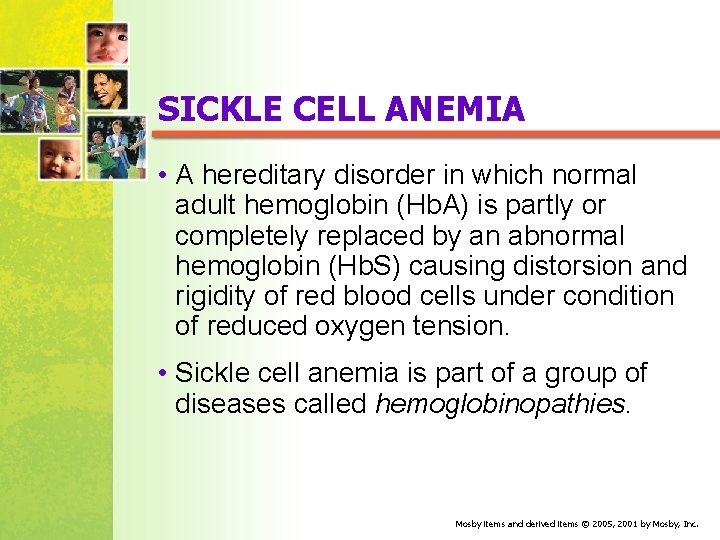 SICKLE CELL ANEMIA • A hereditary disorder in which normal adult hemoglobin (Hb. A)