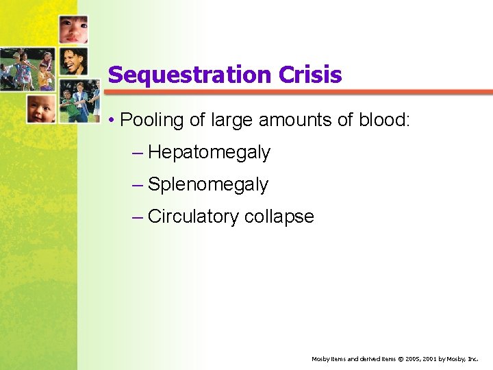 Sequestration Crisis • Pooling of large amounts of blood: – Hepatomegaly – Splenomegaly –
